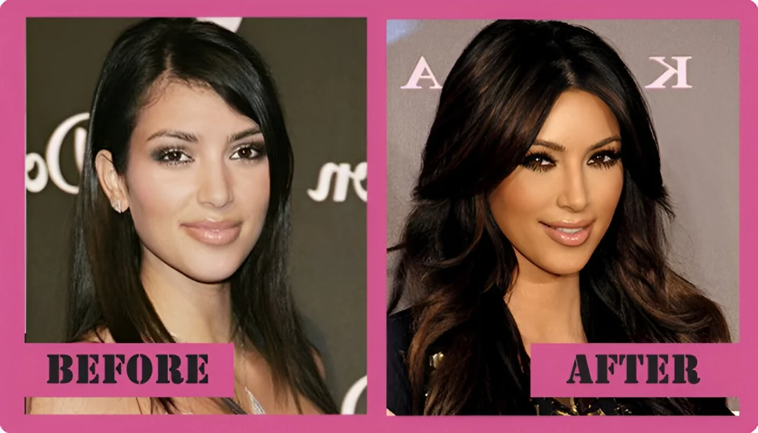 kim kardashian before and after